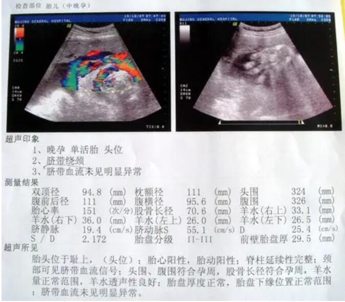 怀孕证明单子图片大全