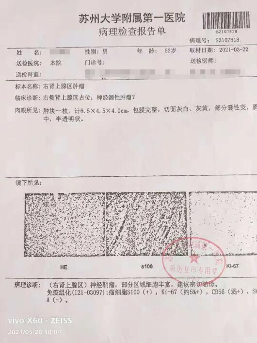 病理报告单图片模板大全