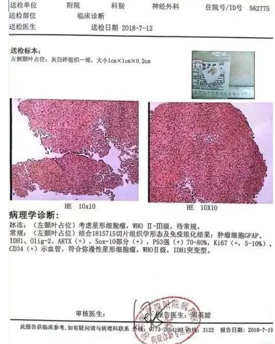 病理报告单图片模板大全