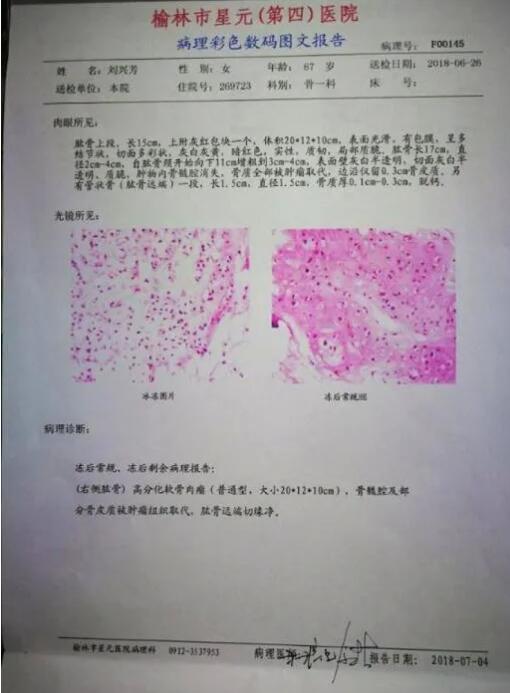 病理报告单图片模板大全