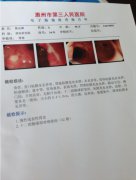 胃出血医院证明图片(共5张图)
