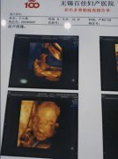 无锡怀孕证明图片模板(5张)