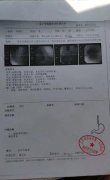 扬州住院病历复印件图片(13张)