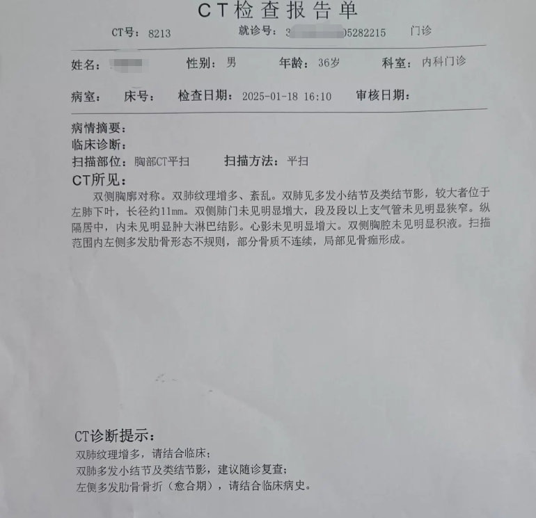 医院CT检查报告单