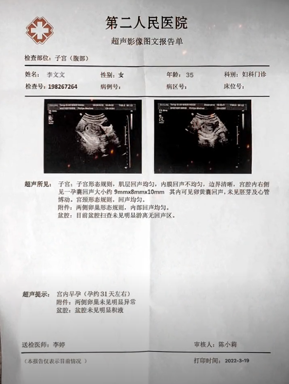 孕检报告单