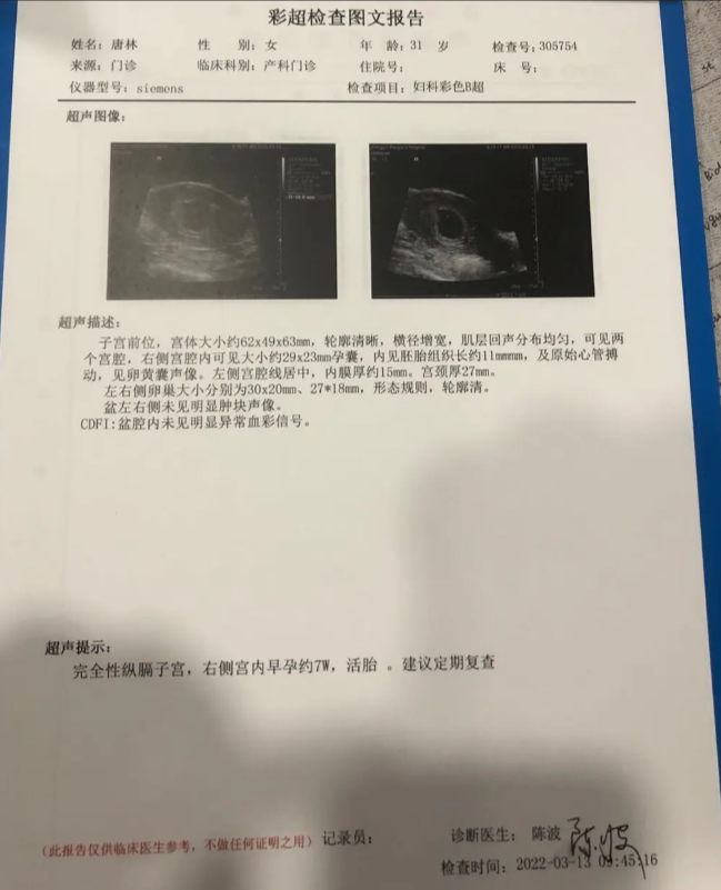 孕检检查图文报告