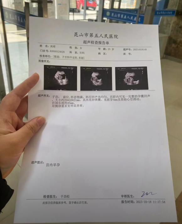 昆山孕检报告单