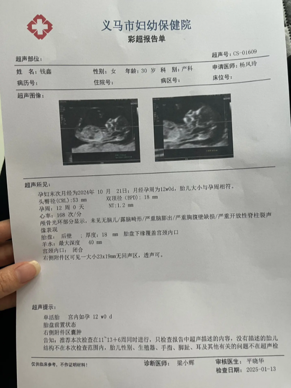 义马市彩超报告电脑