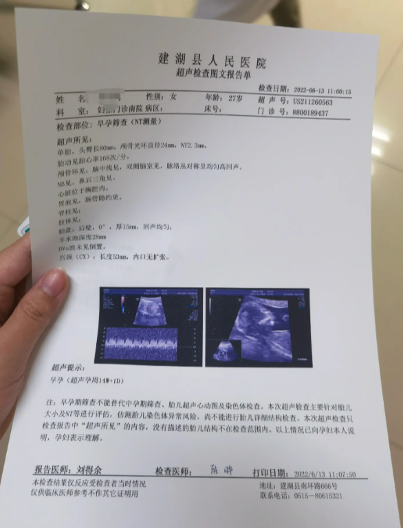 建湖县孕检报告单