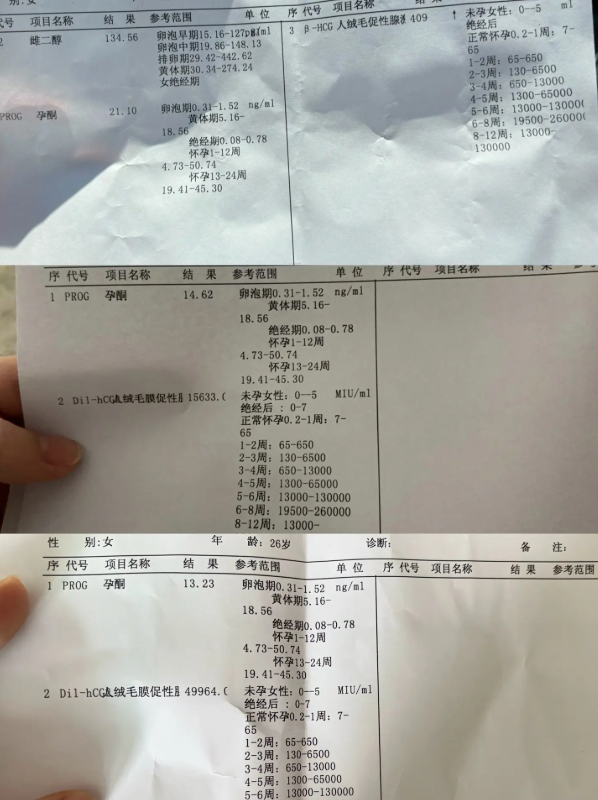 hcg检查报告单