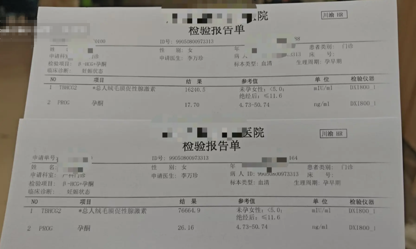 医院hcg报告单