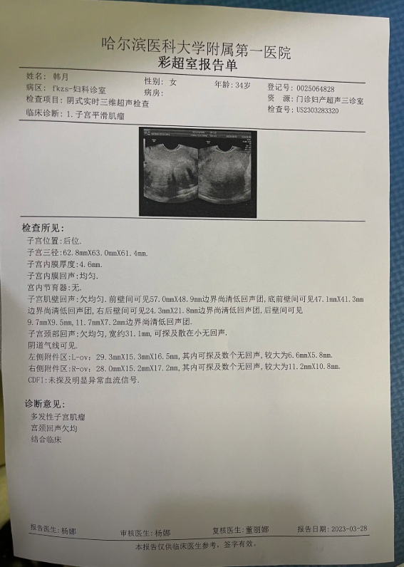 子宫肌瘤检查报告单