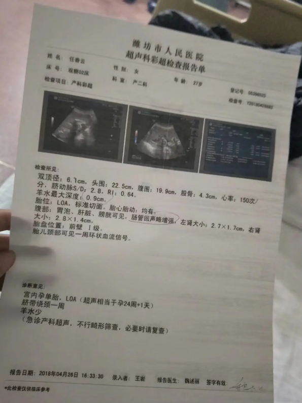 潍坊人民医院B超检查报告单