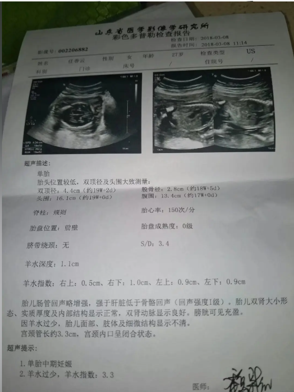 山东省B超报告单