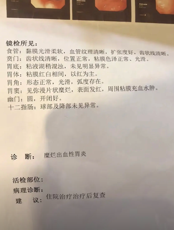 胃病胃镜报告单