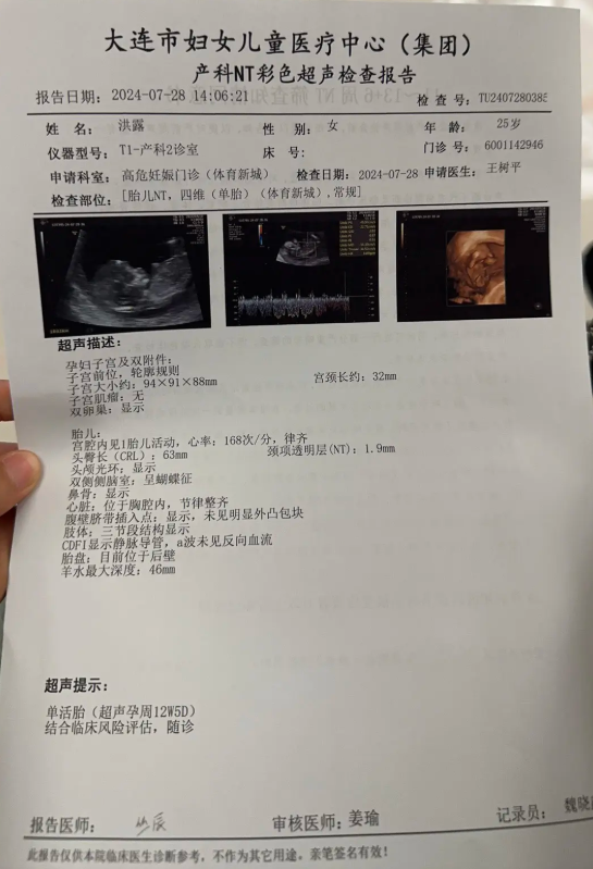 怀孕B超报告单