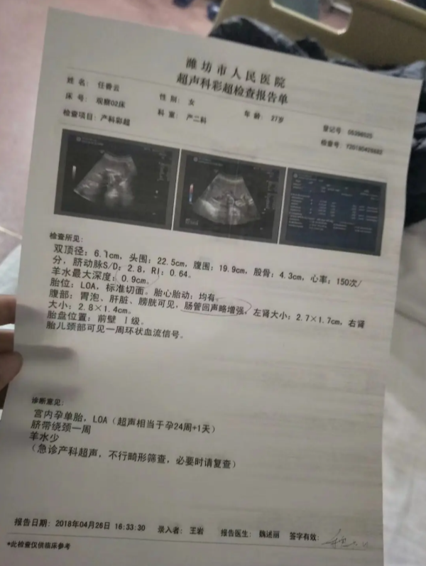 超声彩超报告单