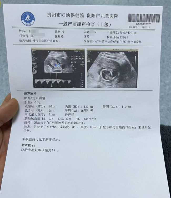 怀孕B超报告