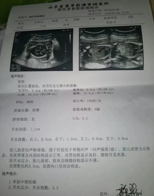 2017潍坊B超怀孕模版