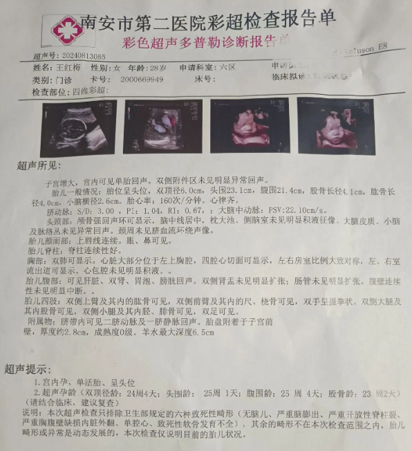 B超报告单样式示例