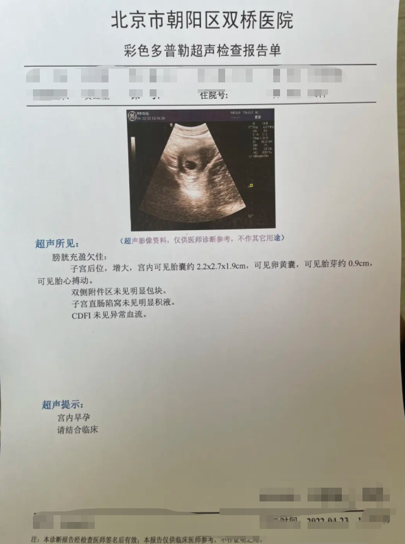 北京医院B超报告单