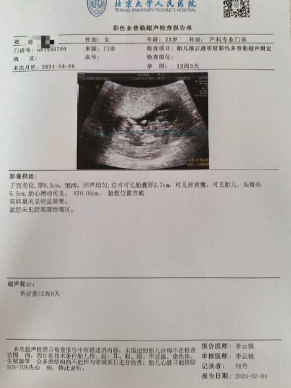 怀孕B超报告单