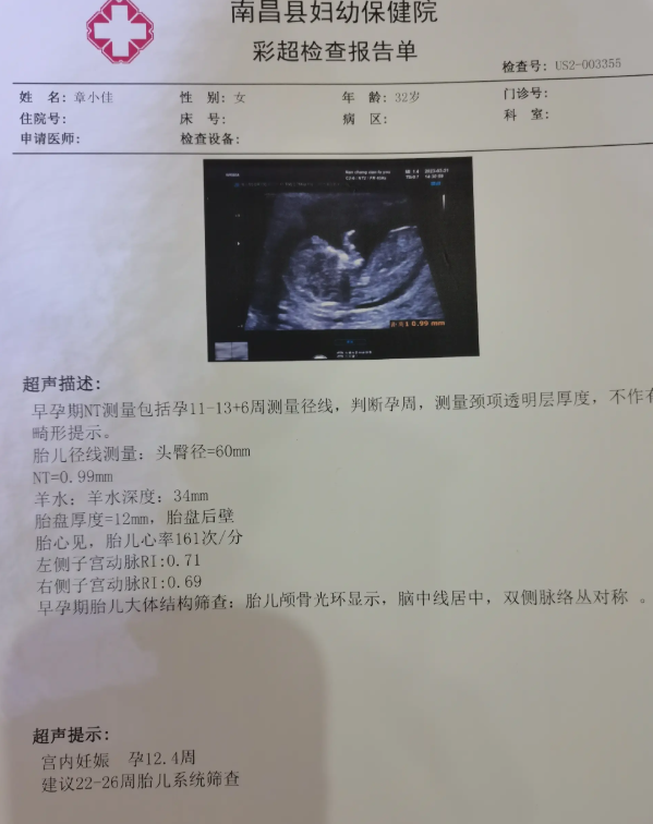 怀孕一个月单子图片