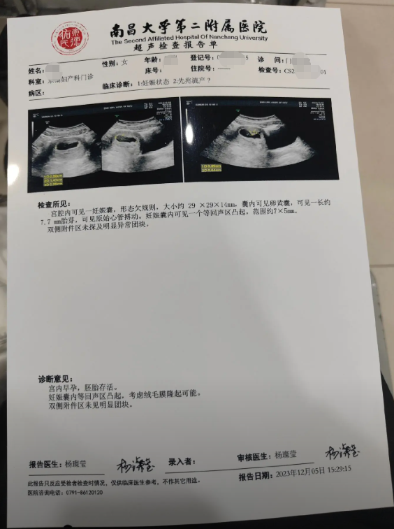 B超怀孕报告单图片