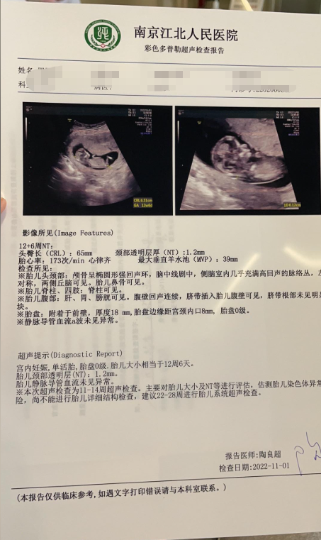 孕12周检查报告单