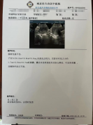 一份孕1-4月怀孕检查报告单图片(4张)