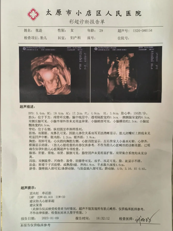 怀孕B超报告单