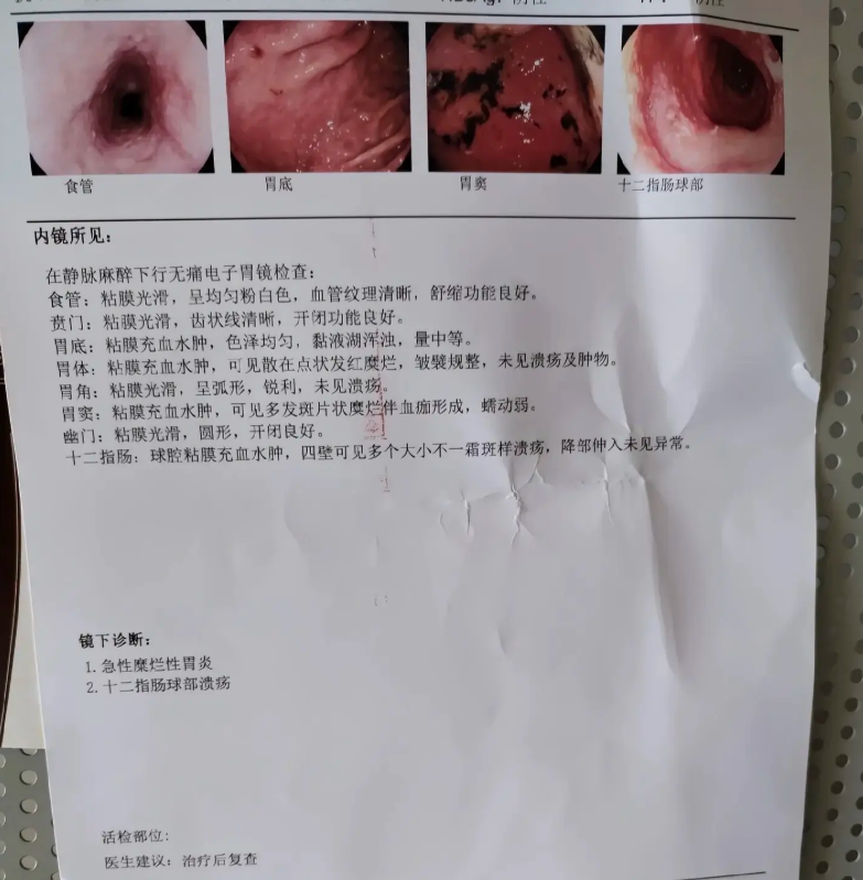 胃镜报告单