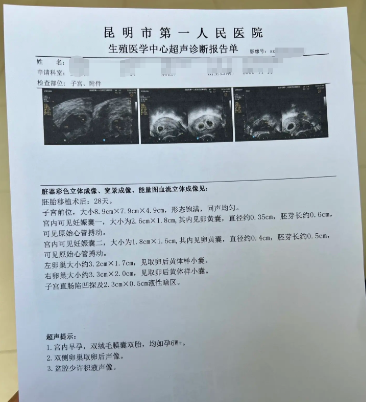 医院开的怀孕报告单