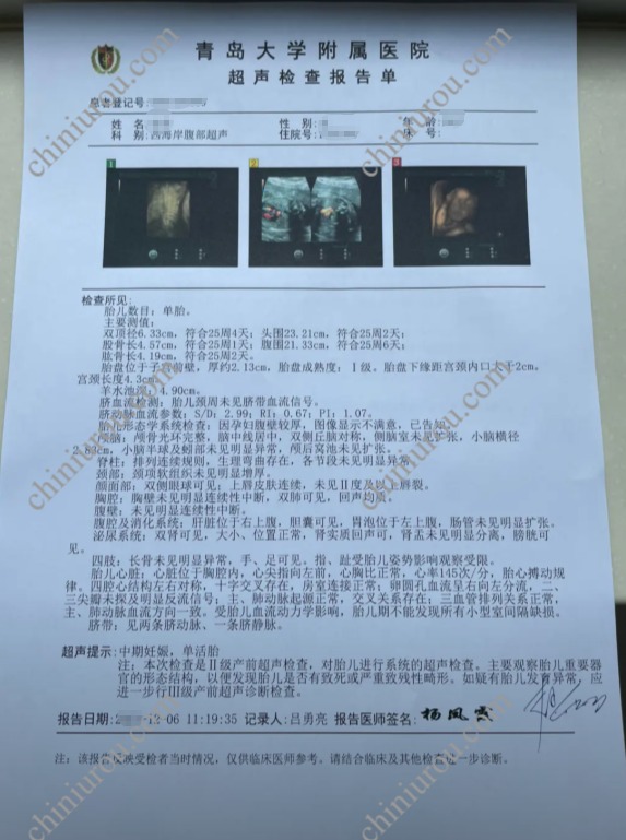 青岛超声检查报告单