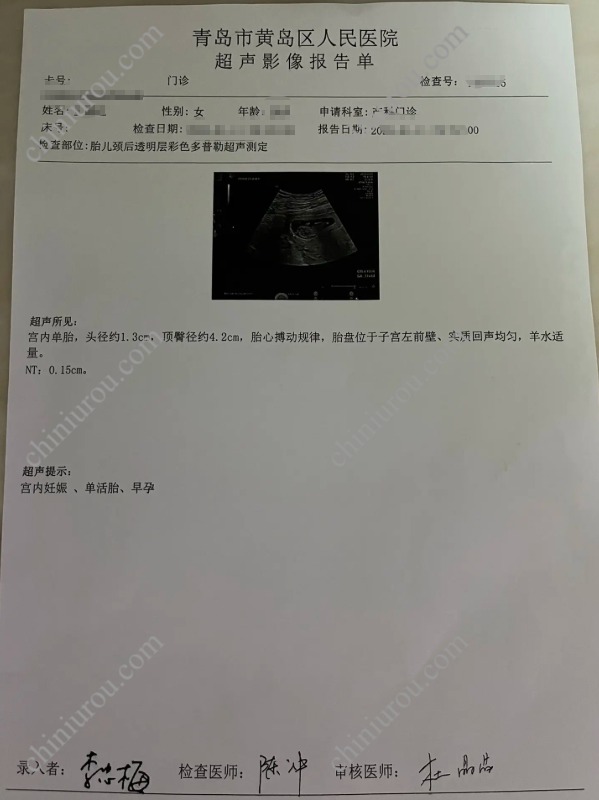 青岛超声影像报告单