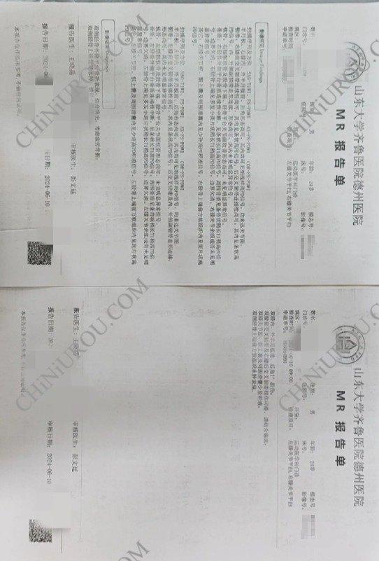 山东大学齐鲁医院德州医院手术证明实拍图片