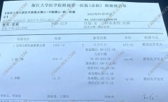 杭州怀孕证明(B超+血HCG报告单示例6张)