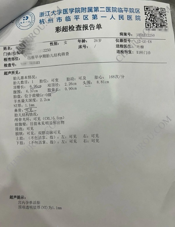 杭州怀孕证明-彩超报告单