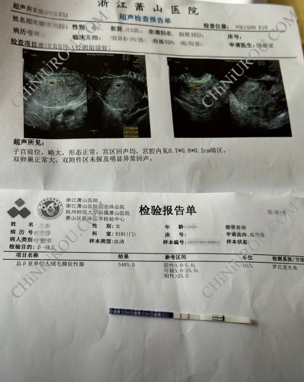 杭州萧山怀孕B超报告单