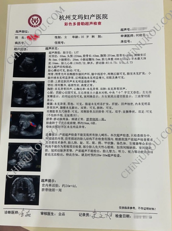 杭州医院彩色多普勒超声报告单