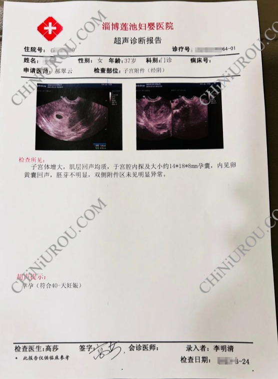 淄博怀孕B超报告单