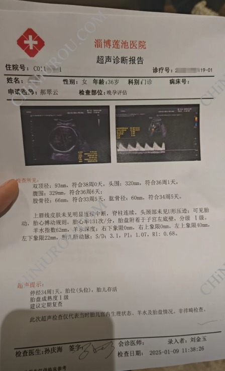 淄博莲池医院超声报告单