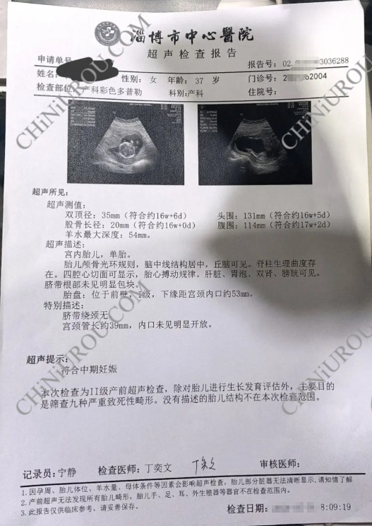 淄博市中心医院产科怀孕报告单