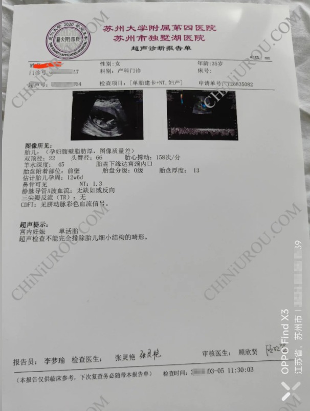 苏州怀孕B超报告单