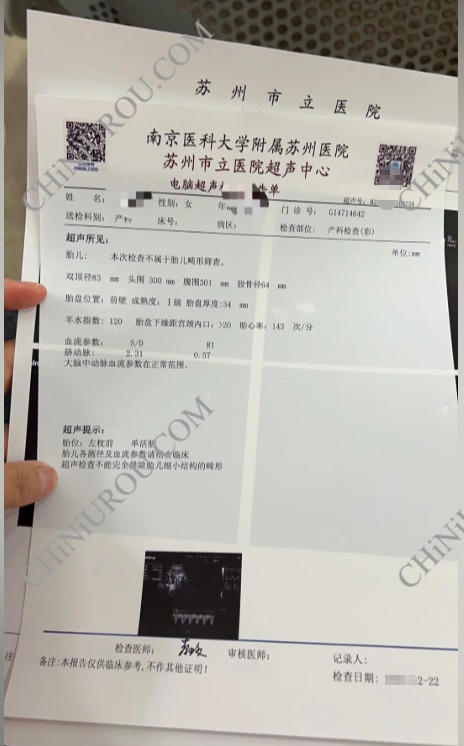 苏州超声报告单图片