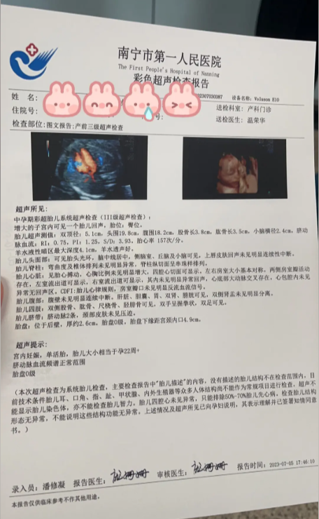 南宁B超检查报告单