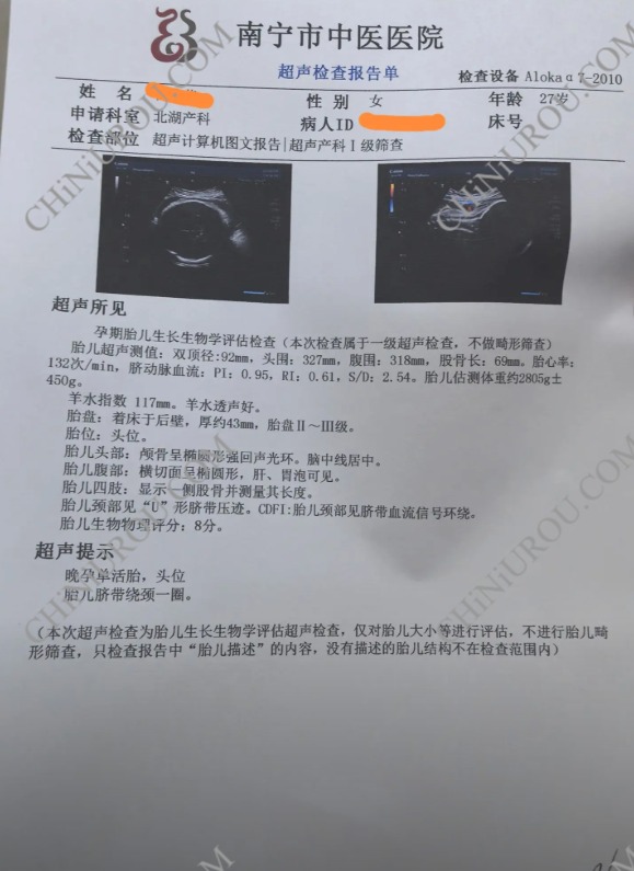 南宁怀孕一个月B超报告单